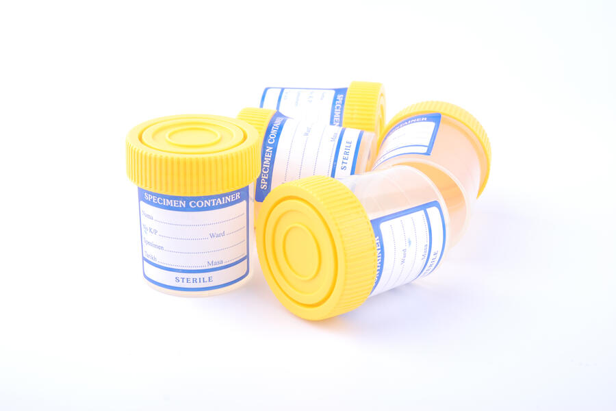 Empty urine test containers with yellow caps