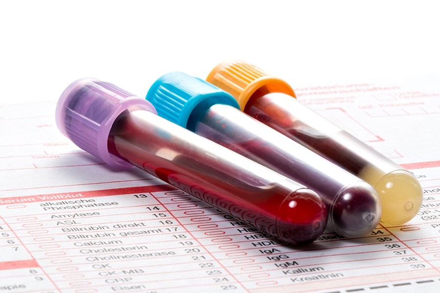 Most Commonly Ordered Blood Tests