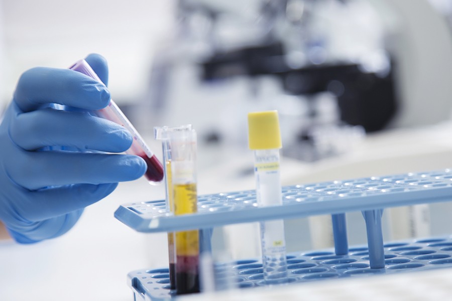 Researchers issue blueprint for phasing out unnecessary blood tests in ...