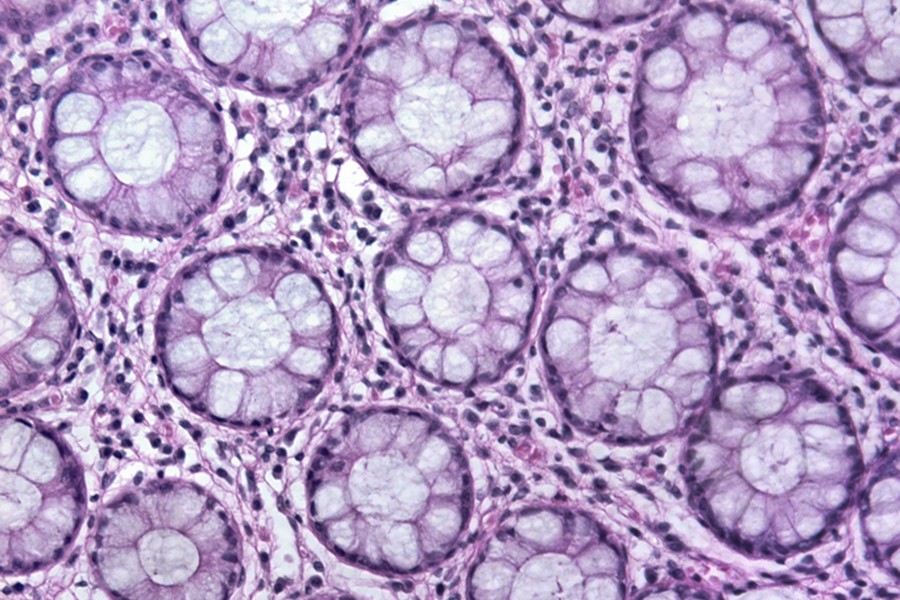 Cellular tissue dyed pink and purple