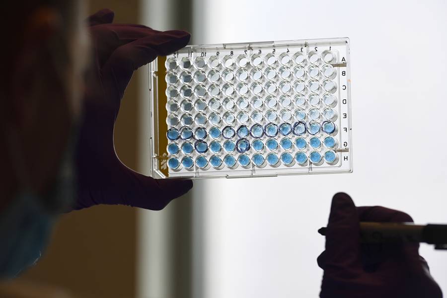A researcher holds up a dish of virus cultures