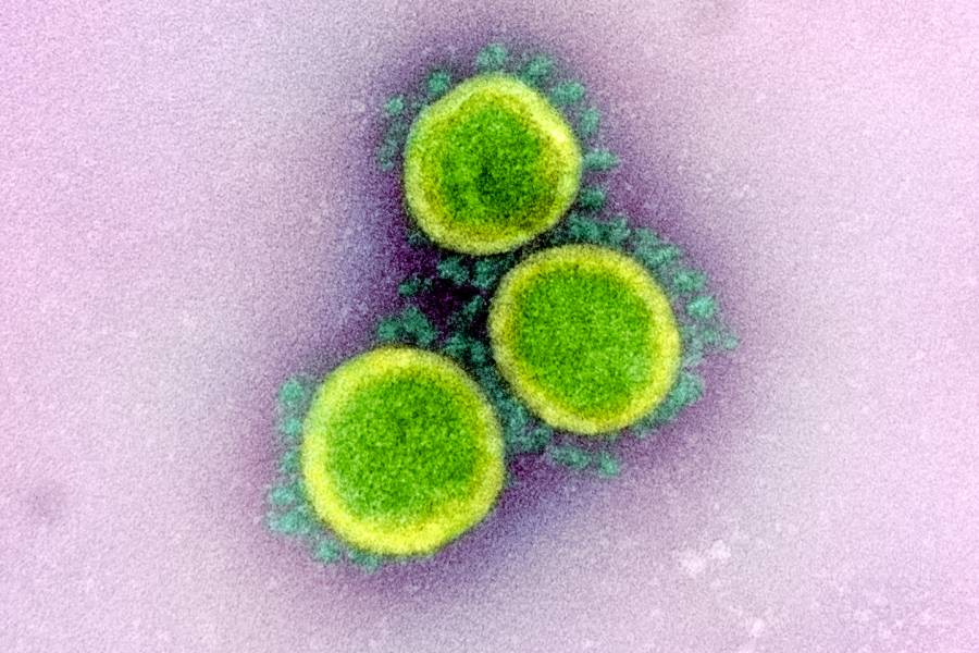 How long can the virus that causes COVID-19 live on surfaces? | Hub
