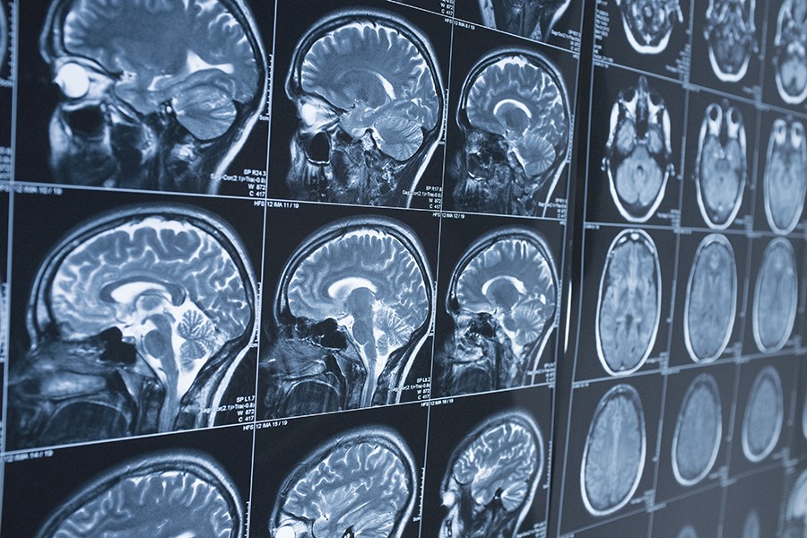 Various brain scans