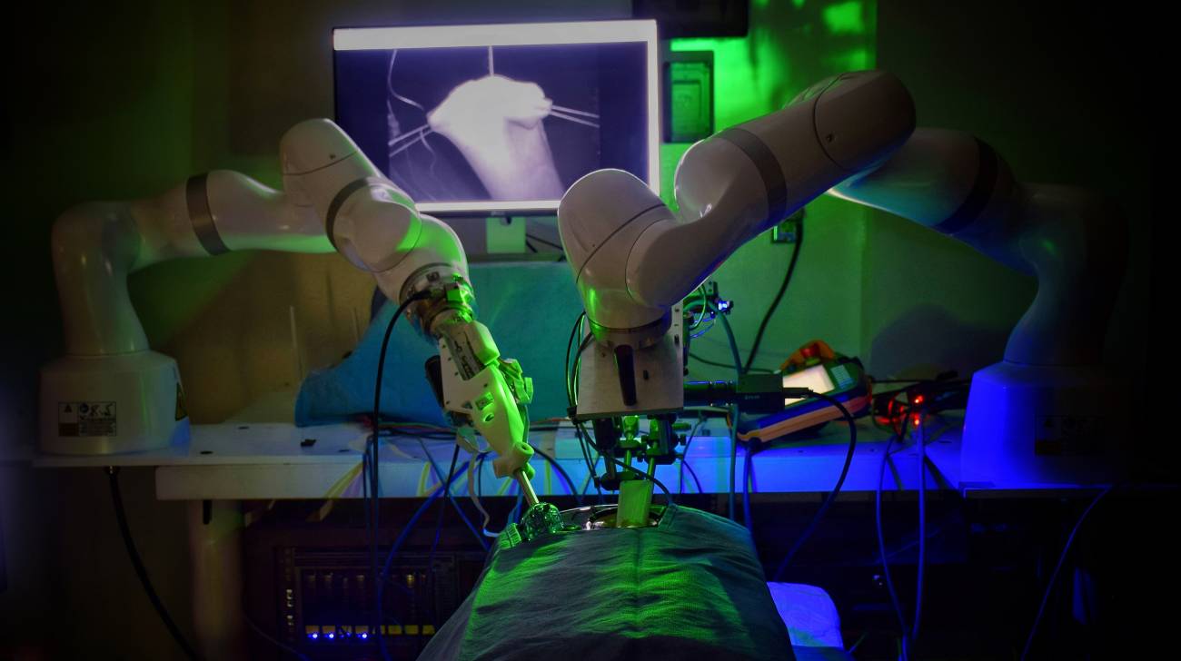Robot performs laparoscopic surgery help |
