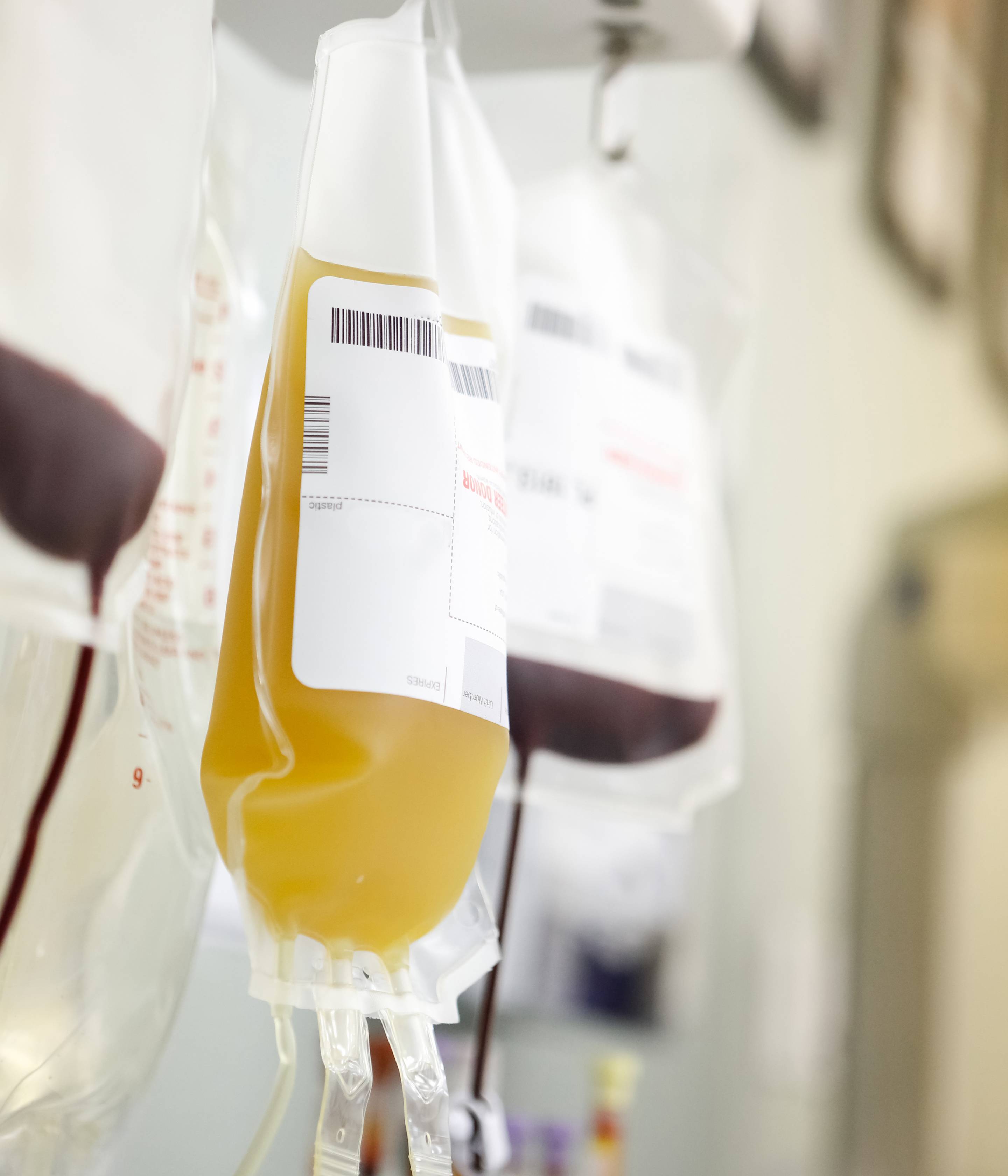 Patients who had more severe COVID-19 may be the best donors for convalescent plasma therapy