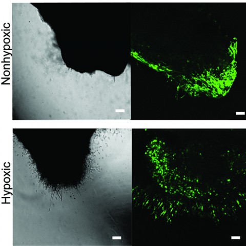 The top image shows a cluster of bright green dots indicating clusters of cancer cells in the nonhypoxic hydrogel. The bottom image shows the hypoxic, or low-oxygen hydrogel and more dispersed green dots, indicating cancer cells that are migrating out